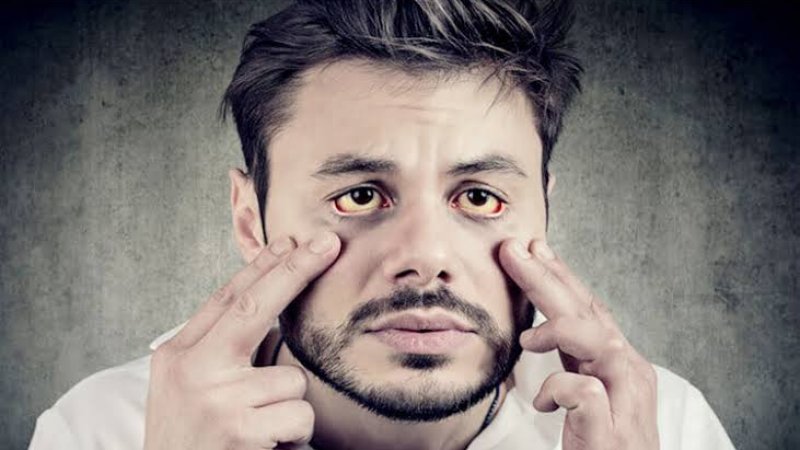 زېړی څنګه منځته راځي؟